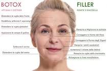 Botulino o Filler? Efficacia, Costi, Effetti Collaterali | X115®